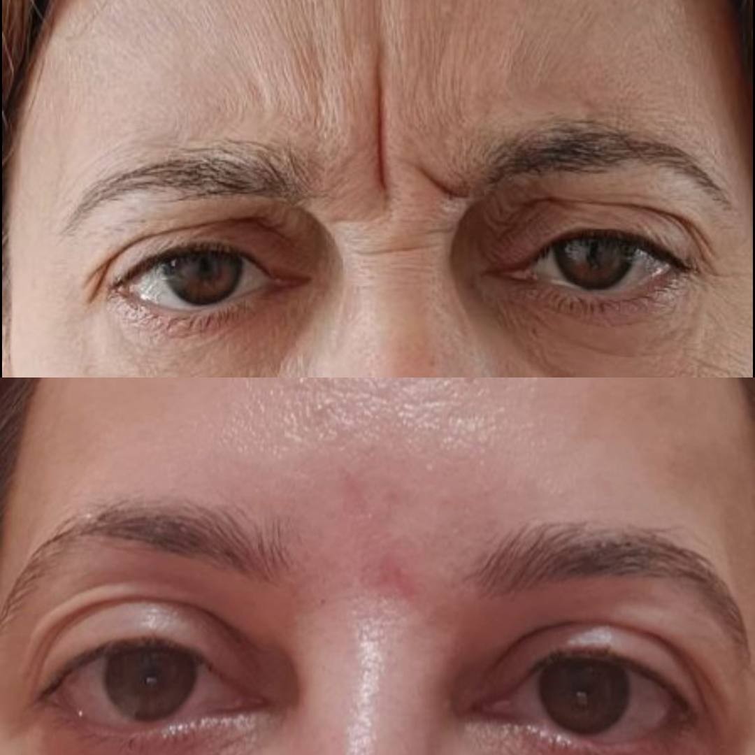 Фото наших работ