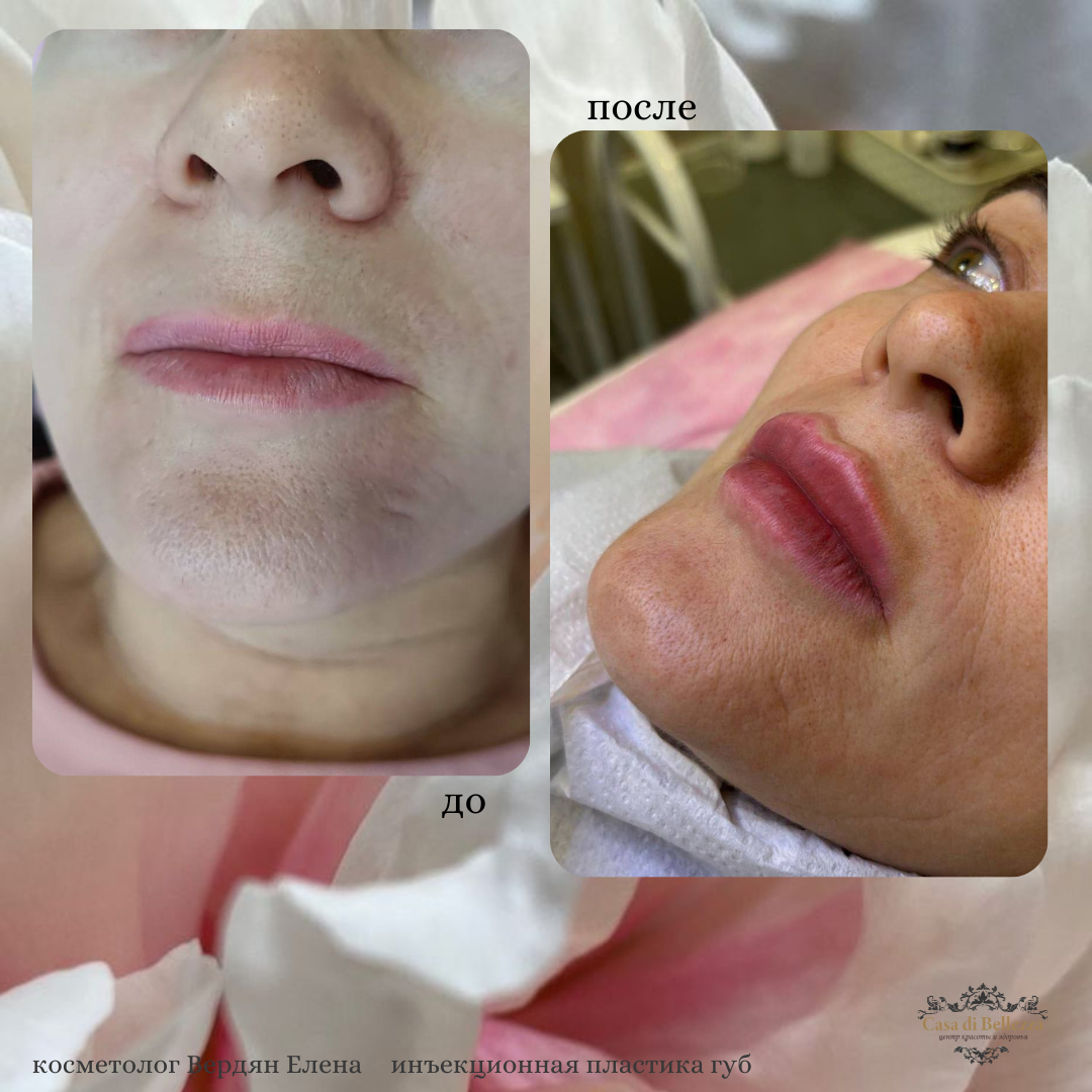 Фото наших работ