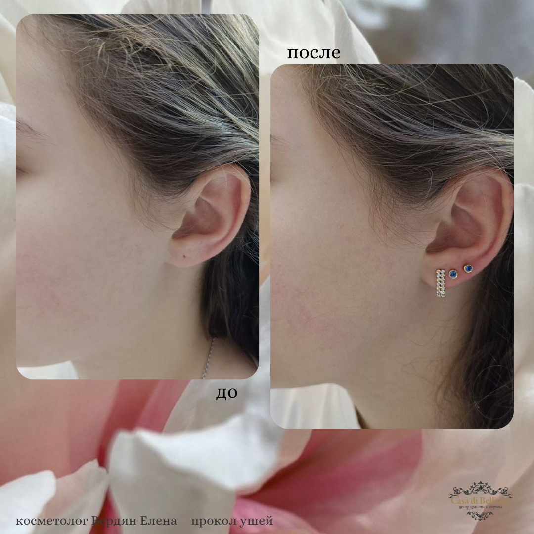 Фото наших работ