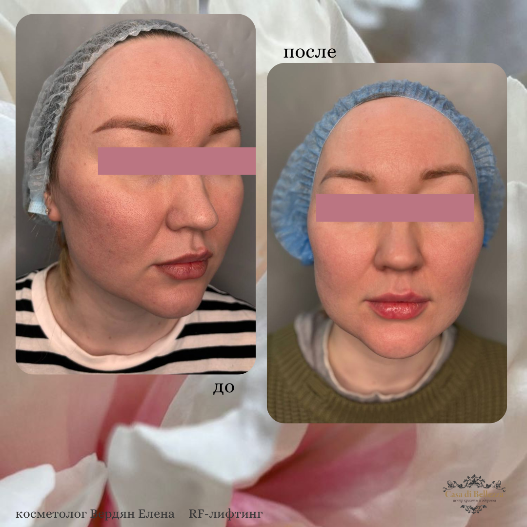 Фото наших работ