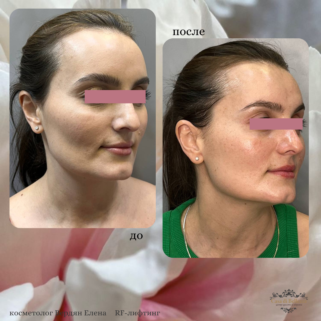 Фото наших работ