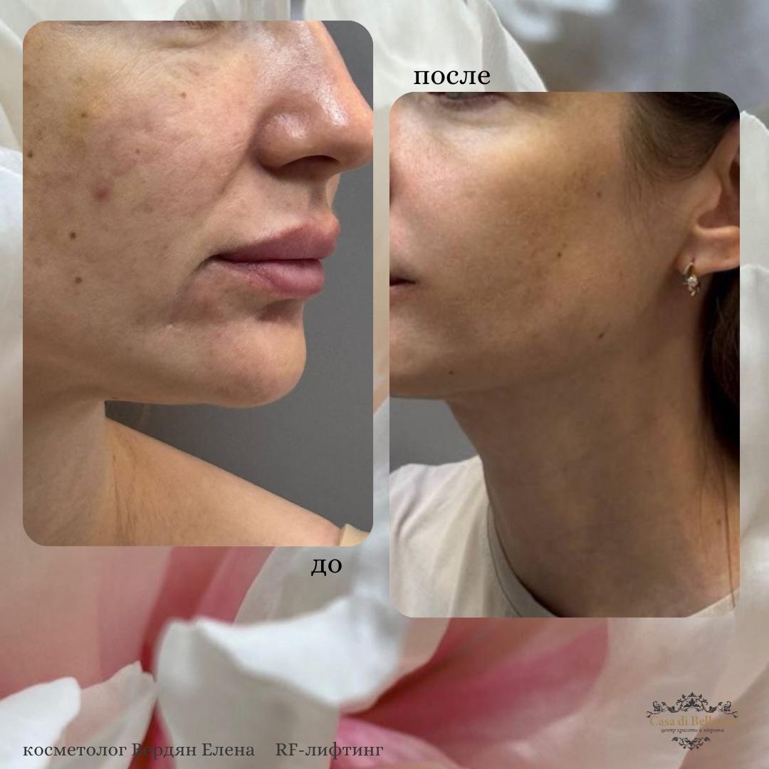 Фото наших работ