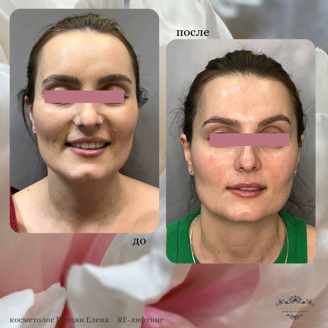 Фото наших работ