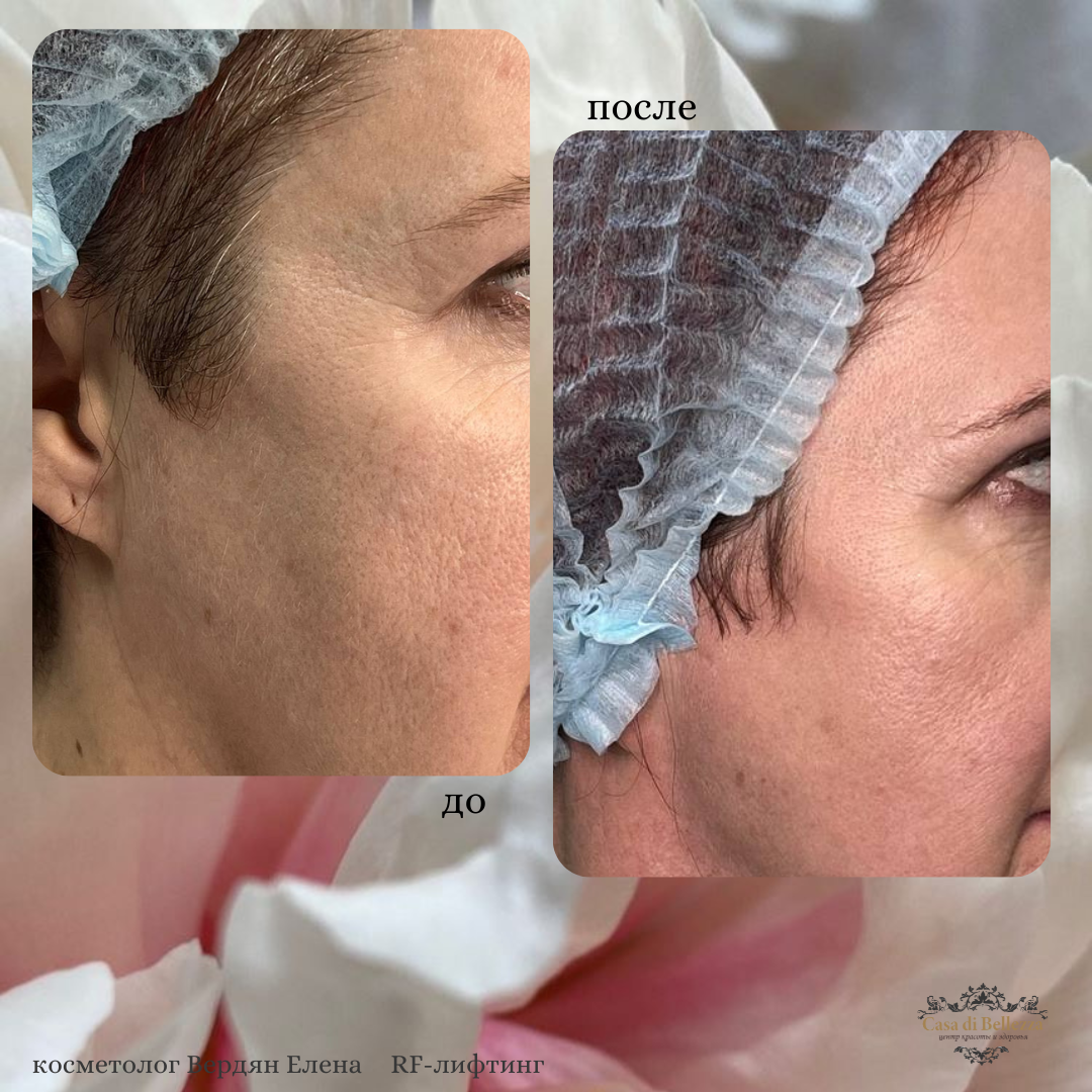 Фото наших работ