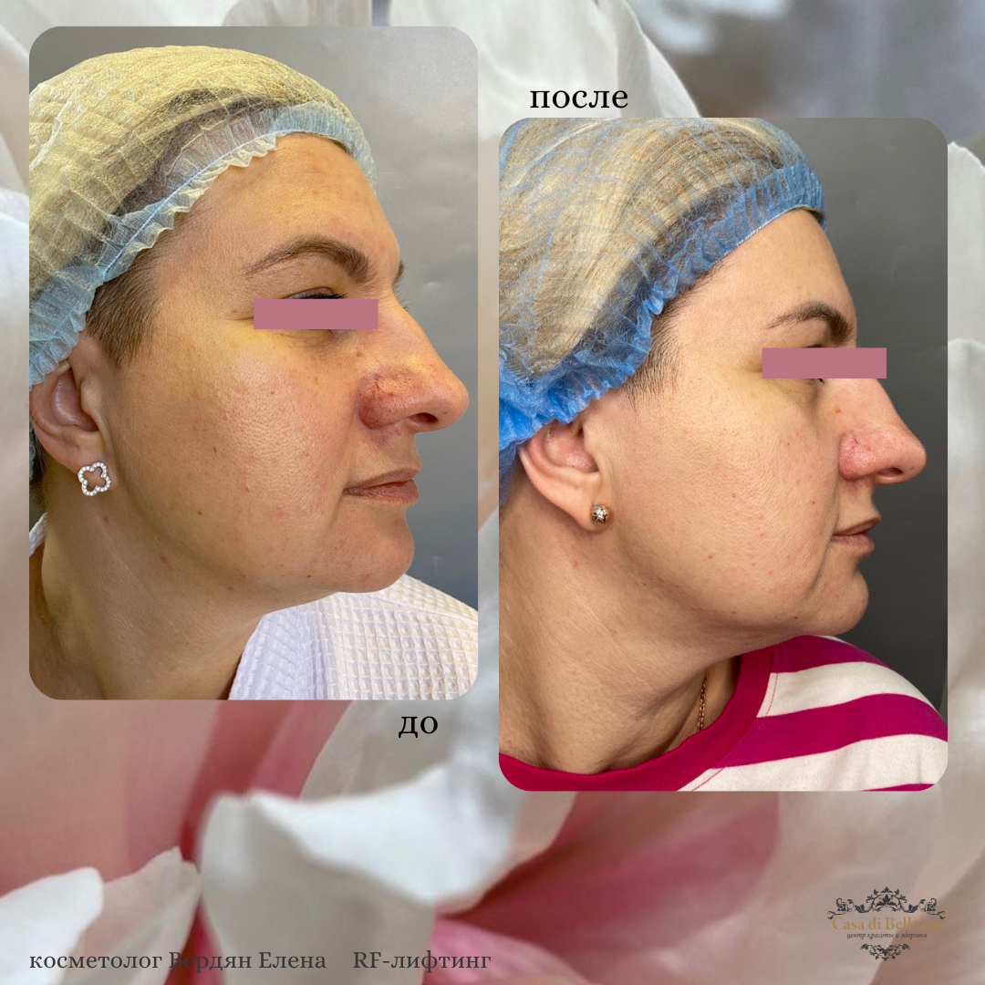 Фото наших работ