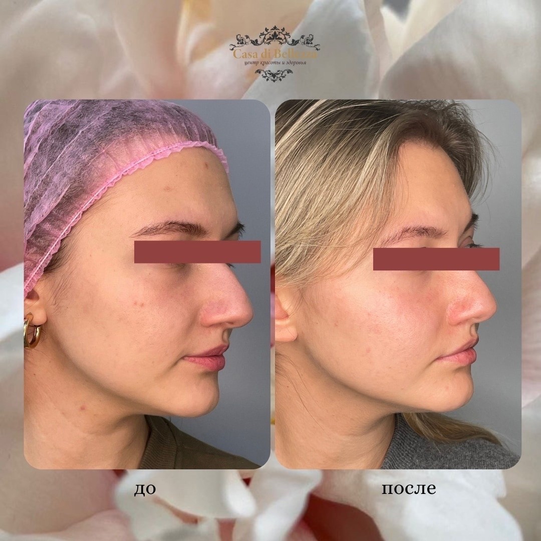 Фото наших работ