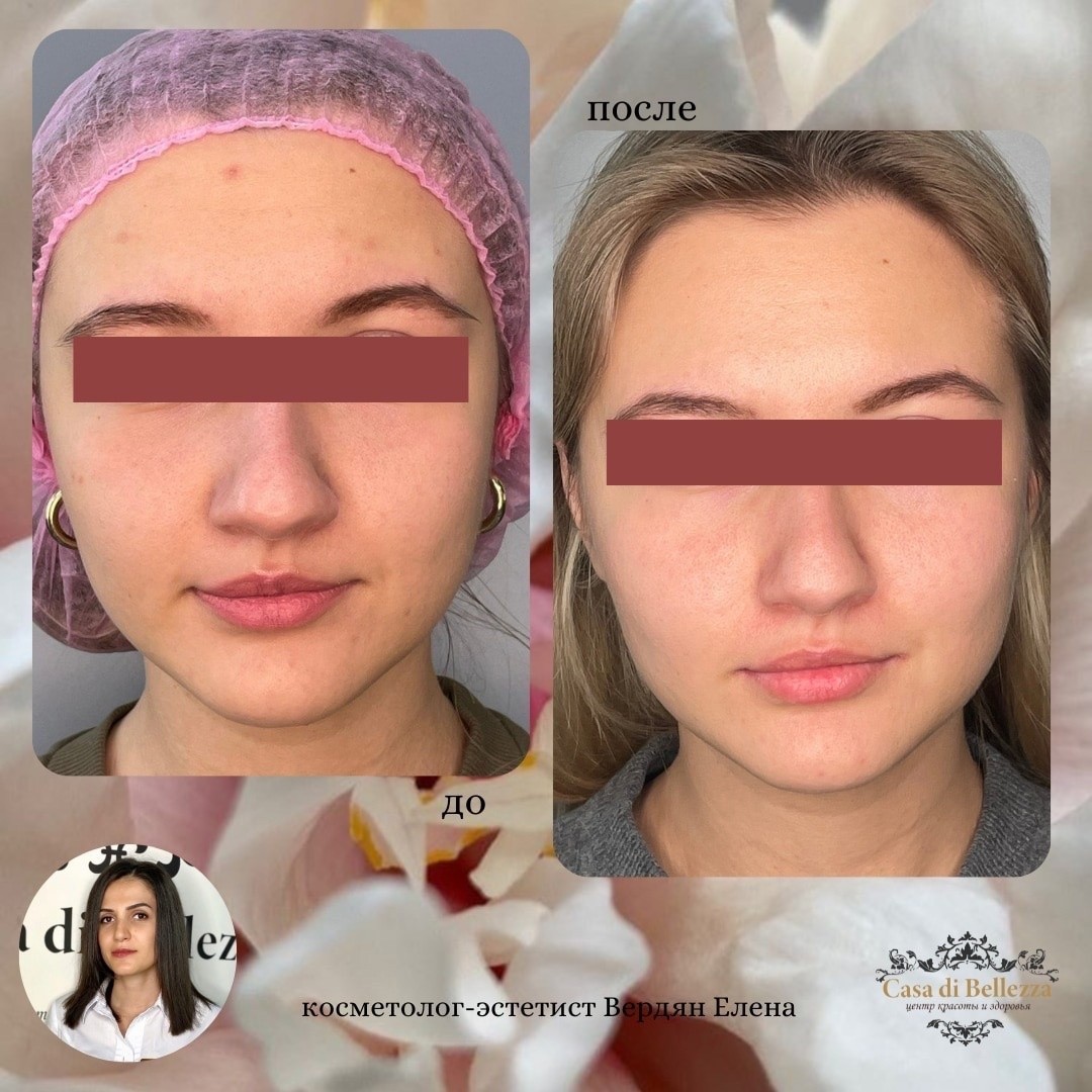 Фото наших работ