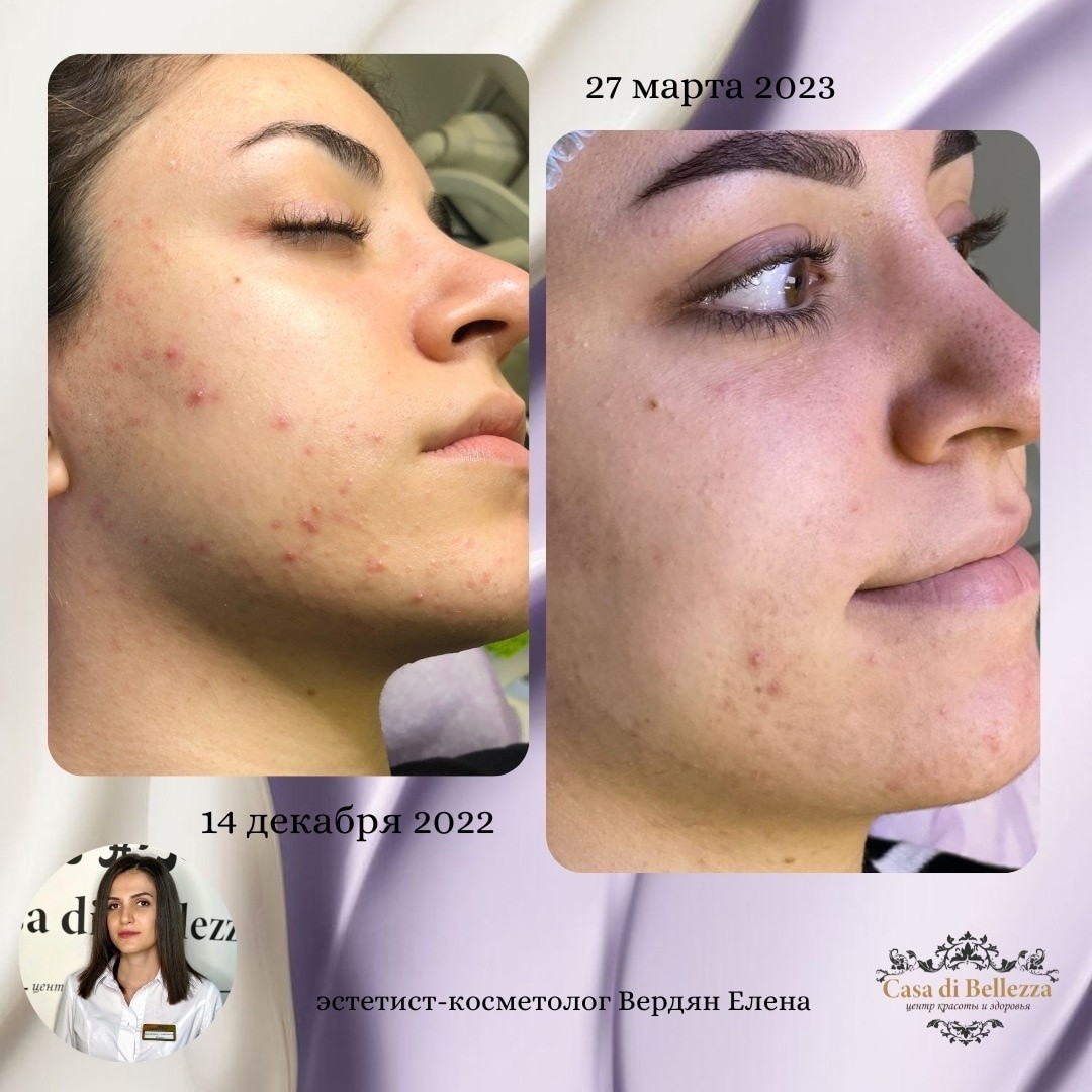 Фото наших работ