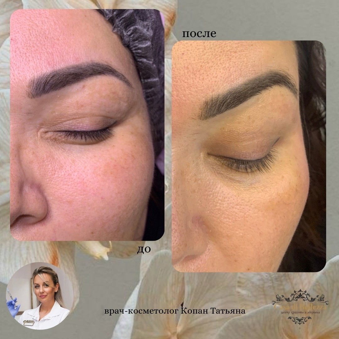 Фото наших работ