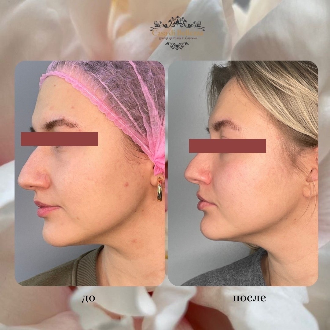 Фото наших работ