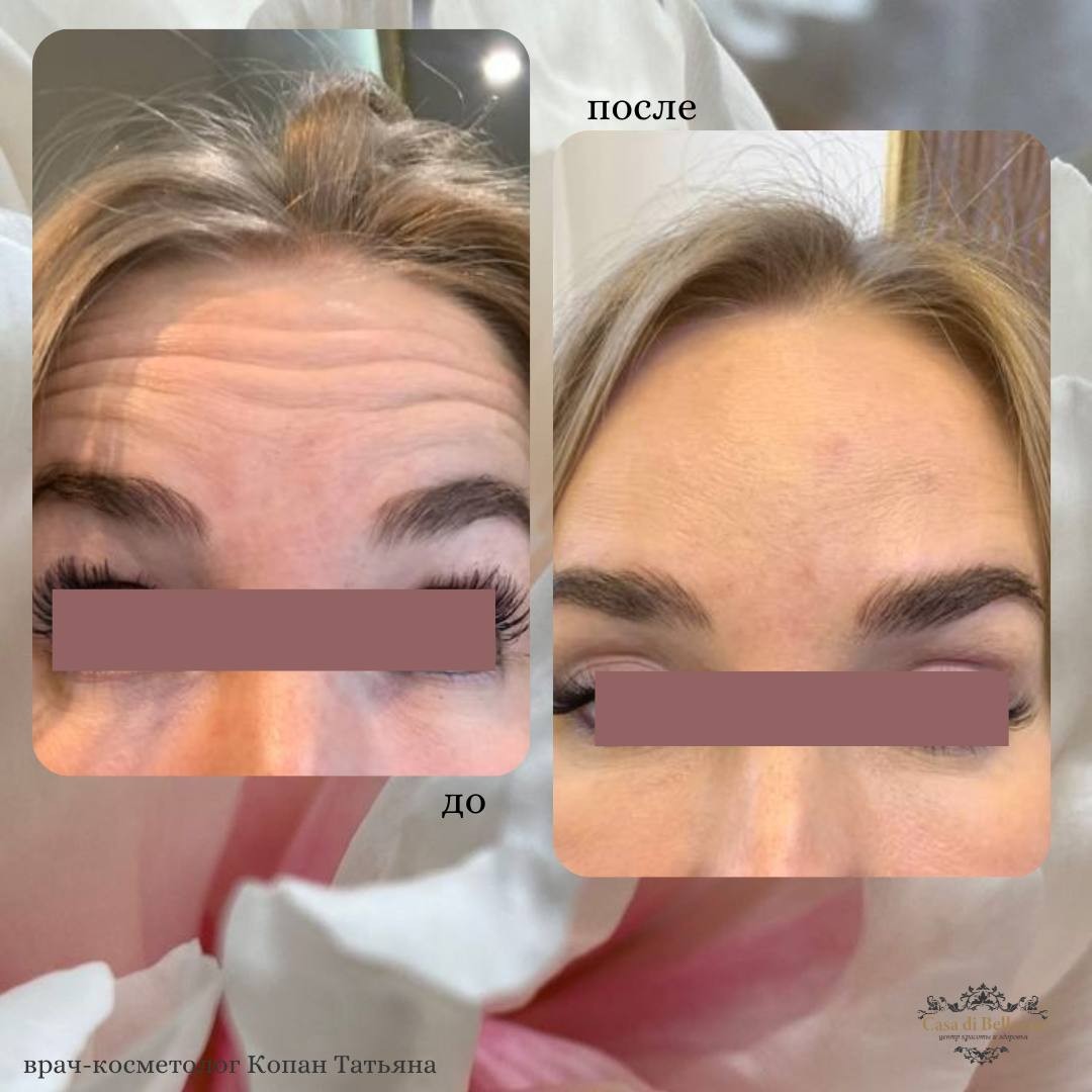 Фото наших работ