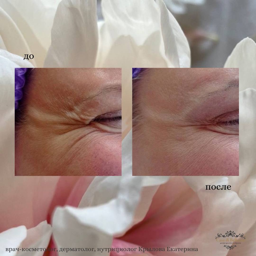 Фото наших работ