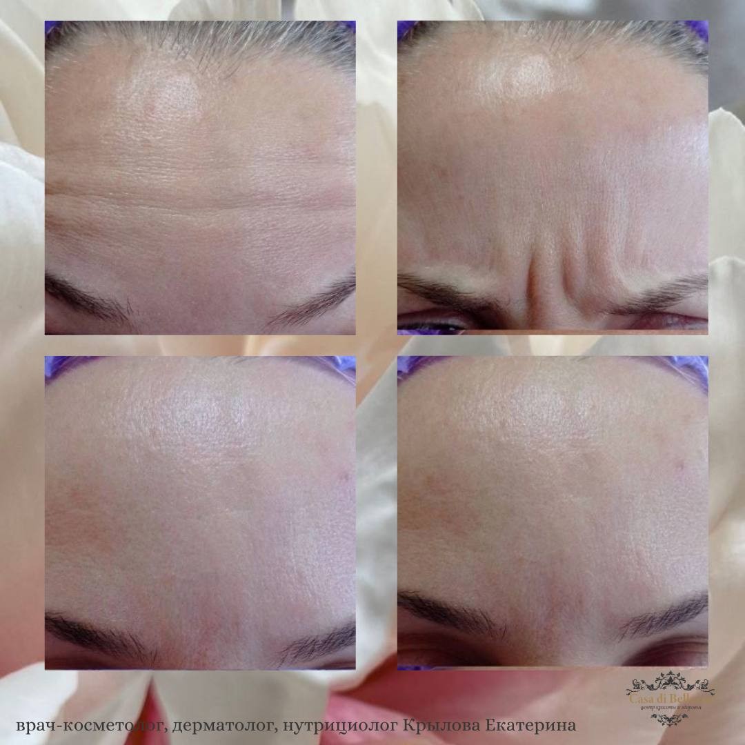 Фото наших работ