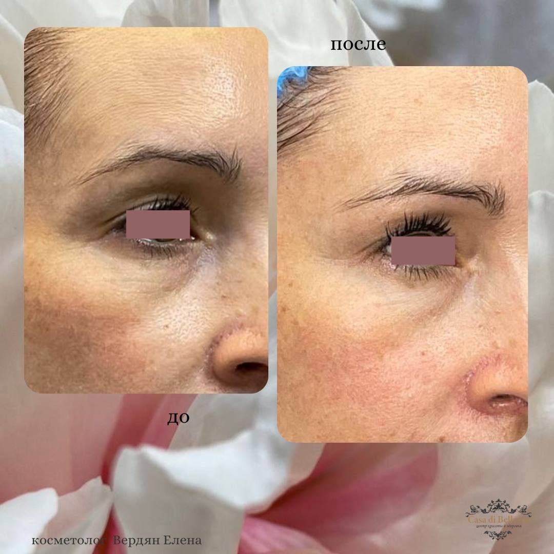 Фото наших работ