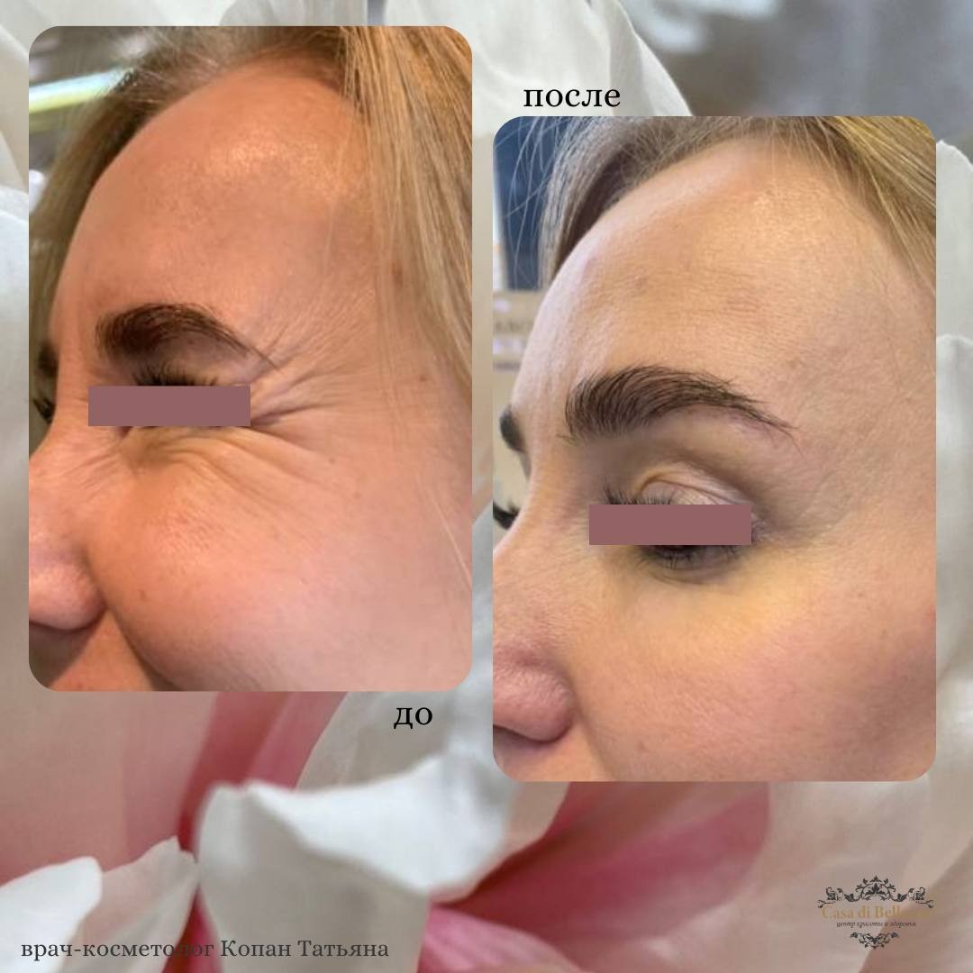 Фото наших работ