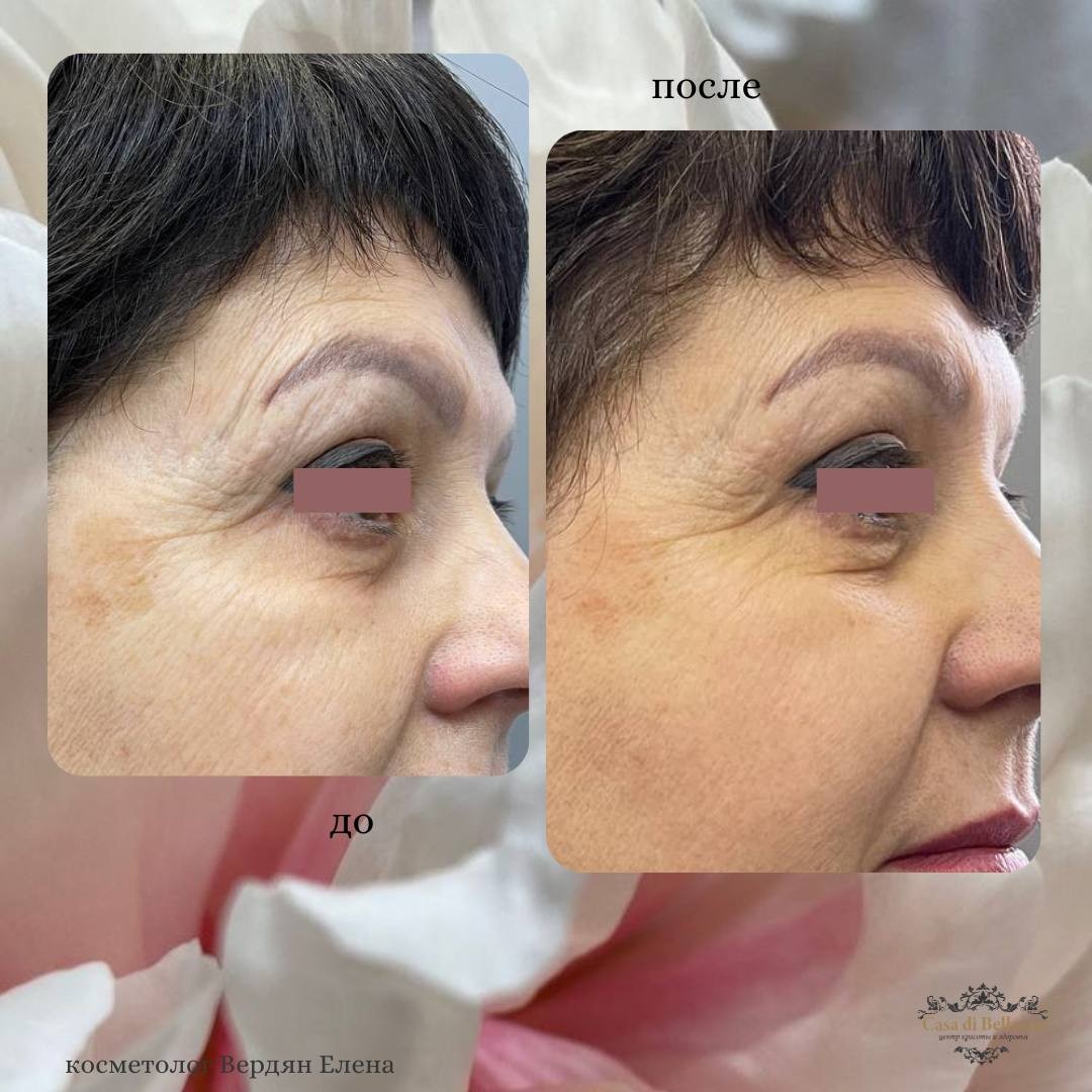 Фото наших работ