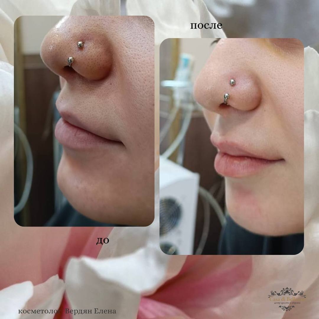 Фото наших работ