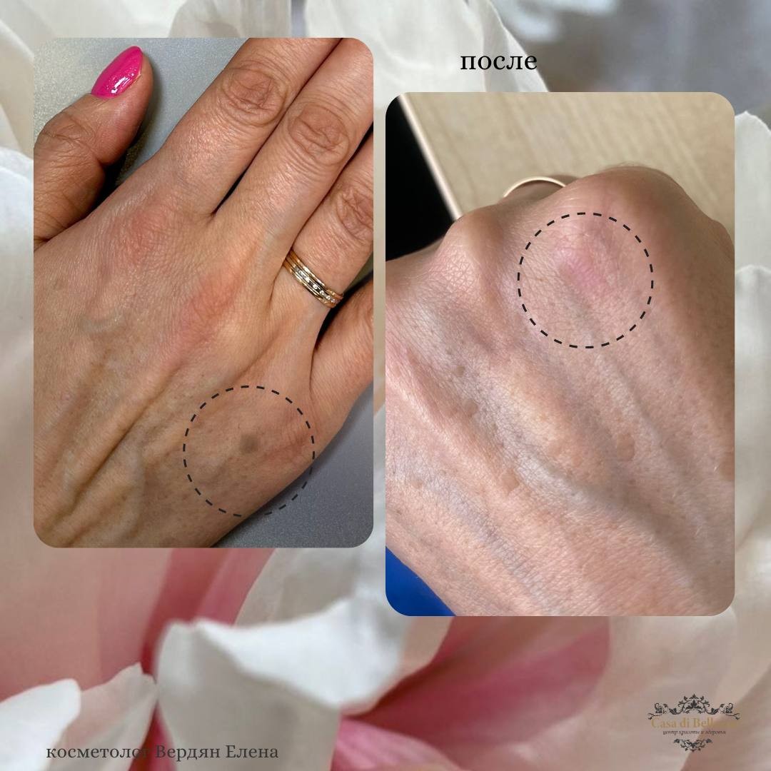 Фото наших работ