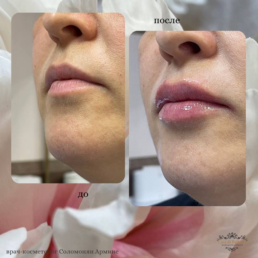 Фото наших работ