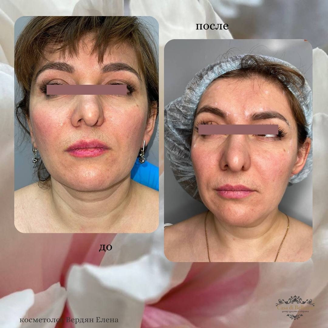 Фото наших работ