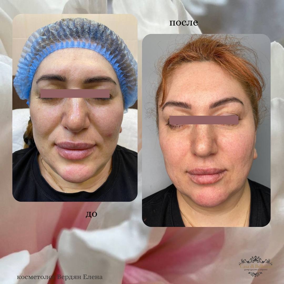 Фото наших работ