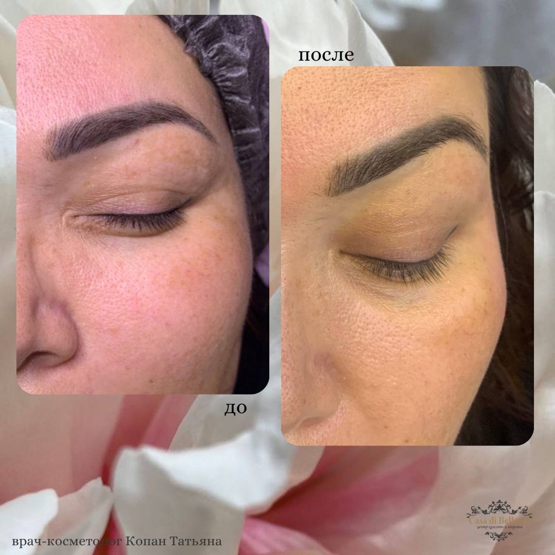 Фото наших работ