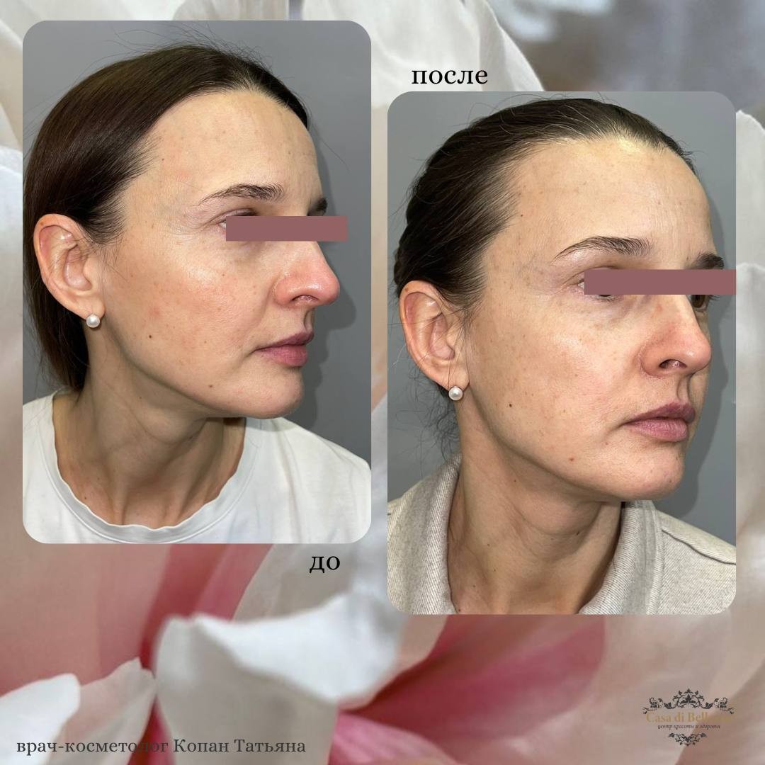 Фото наших работ