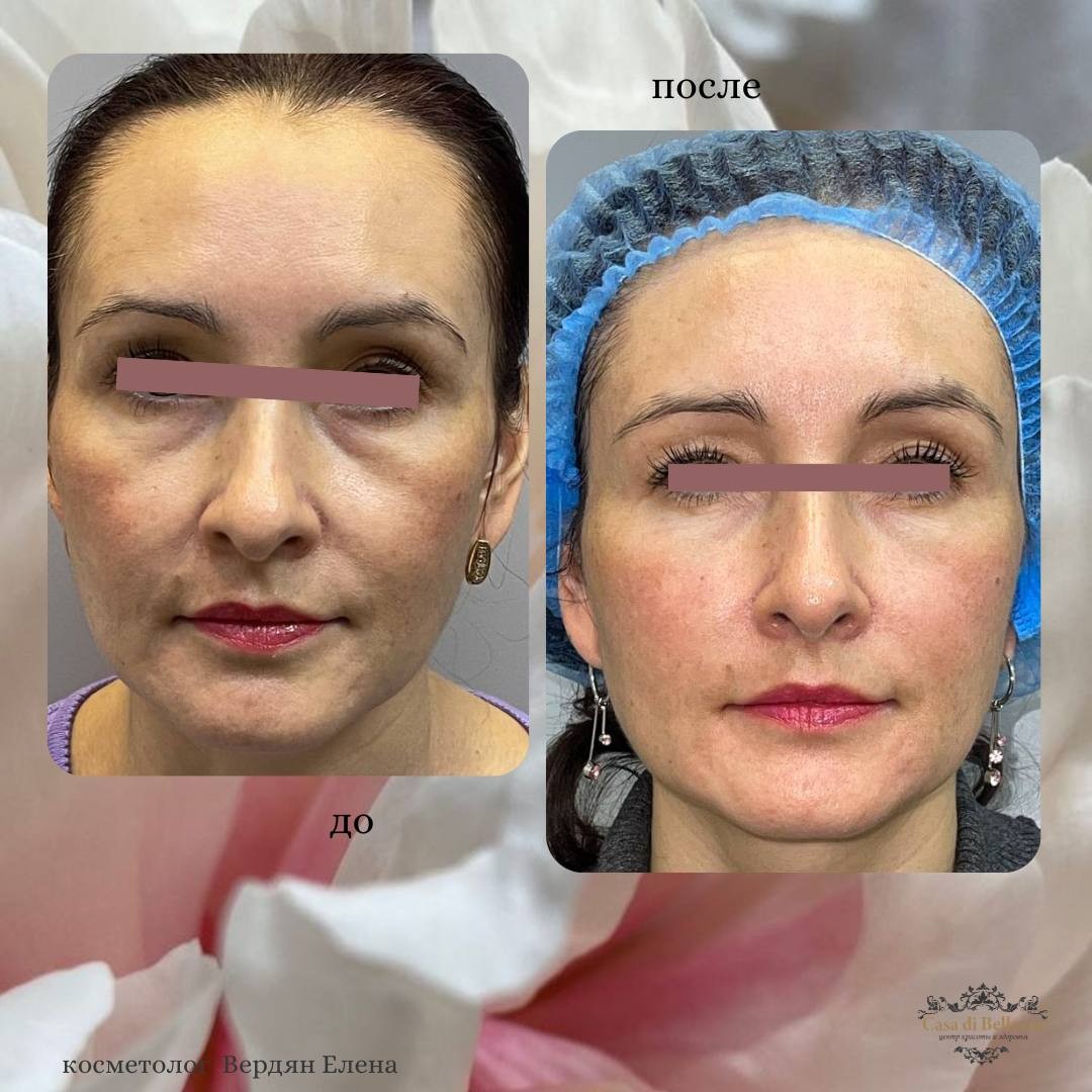 Фото наших работ