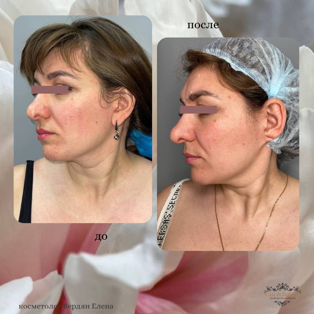 Фото наших работ