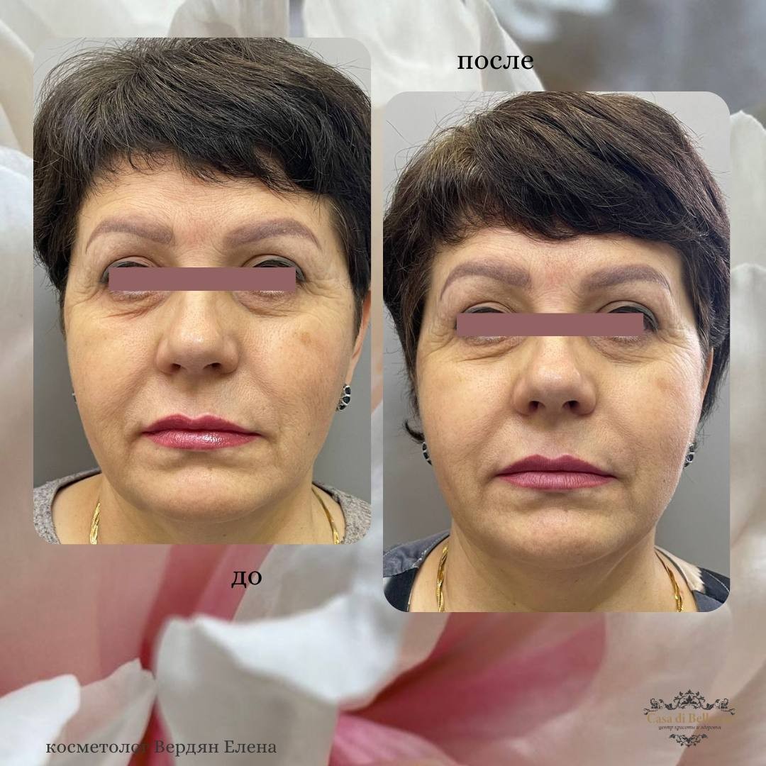 Фото наших работ