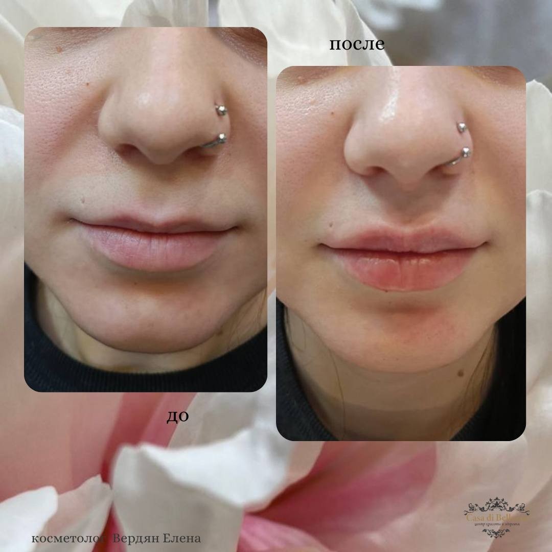 Фото наших работ