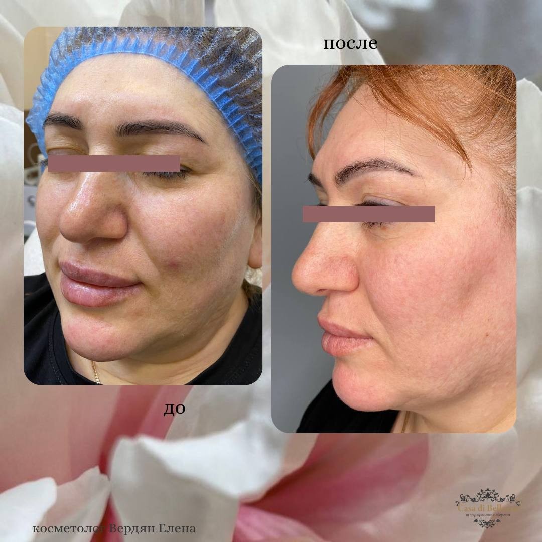 Фото наших работ