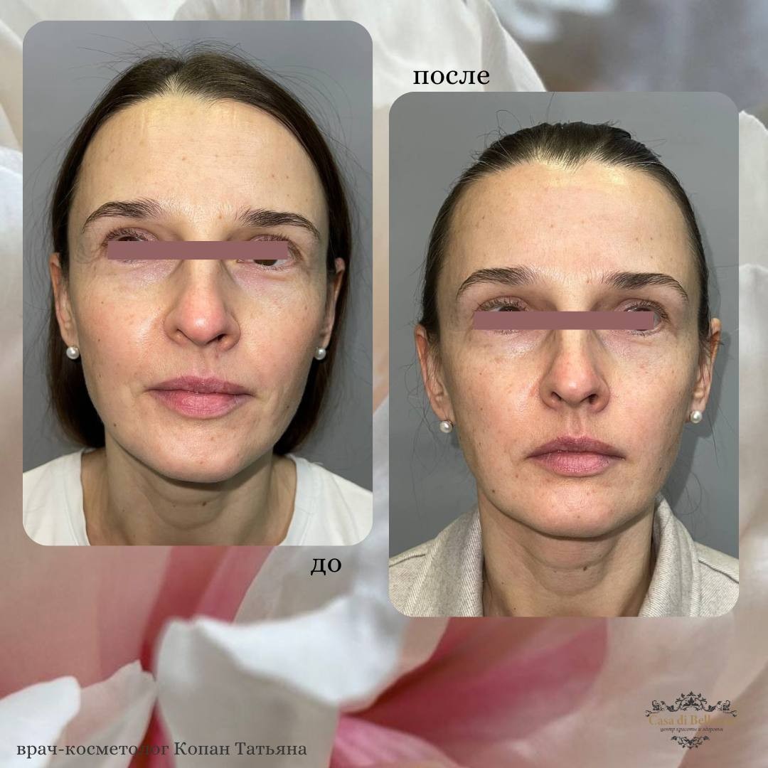 Фото наших работ