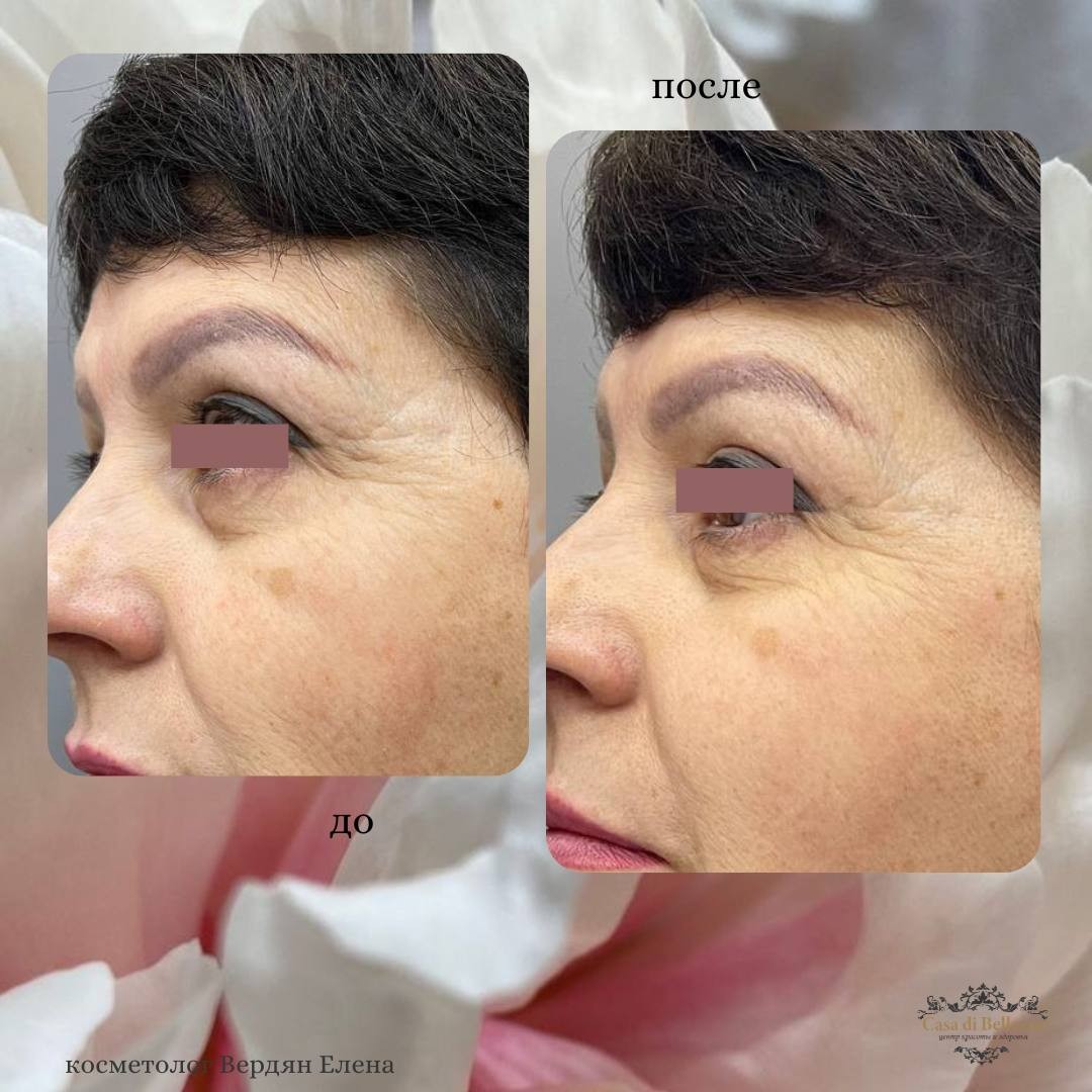 Фото наших работ